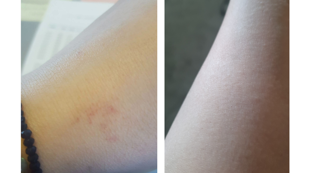 Aysel Resultater.png