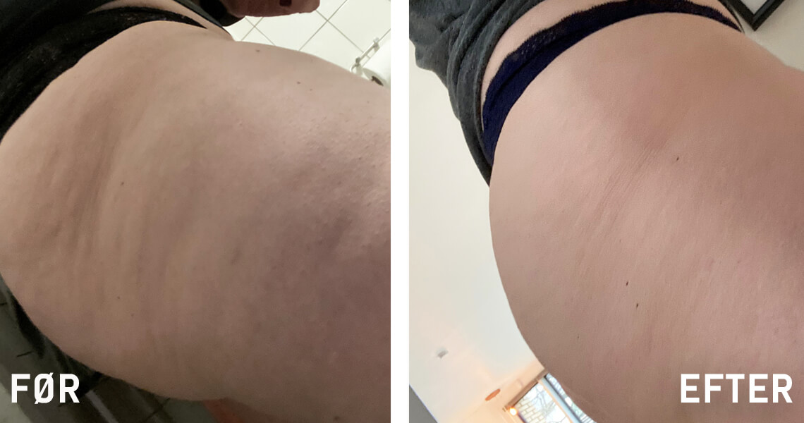 OSL_before-after_Nadja1_1140x600_0520_DK.jpg